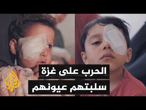 أكثر 1500 شخص في قطاع غزة فقدوا بصرهم خلال الحرب