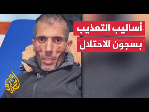 أسير محرر يتحدث عن سبل التعذيب التي يتعرض لها الأسرى في سجون الاحتلال